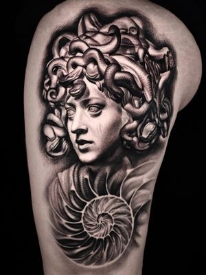 Partly healed and partly fresh Medusa on leg.