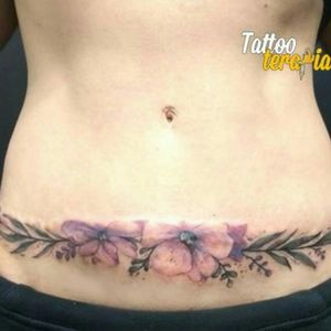Cobertura de cicatriz de abdominoplastia feita pela tatuador Fran. Whatsapp 11991626438