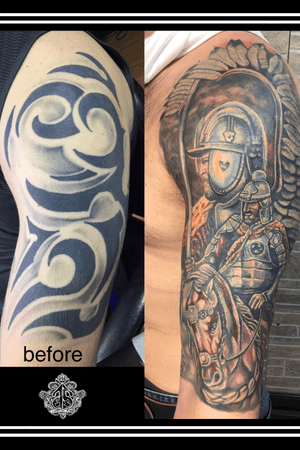 9 session process with no lazer removal treatment. a