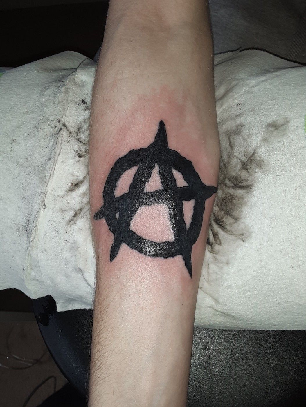 Tattoo of Anarchy Symbols Cover Up