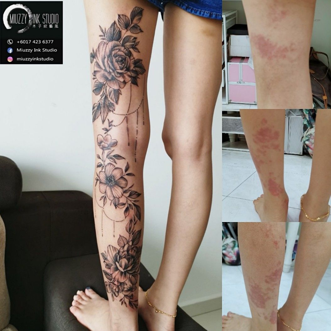30 Times Tattoo Artists Made Incredible Scar And Birthmark Cover Up Tattoos  New Pics  DeMilked