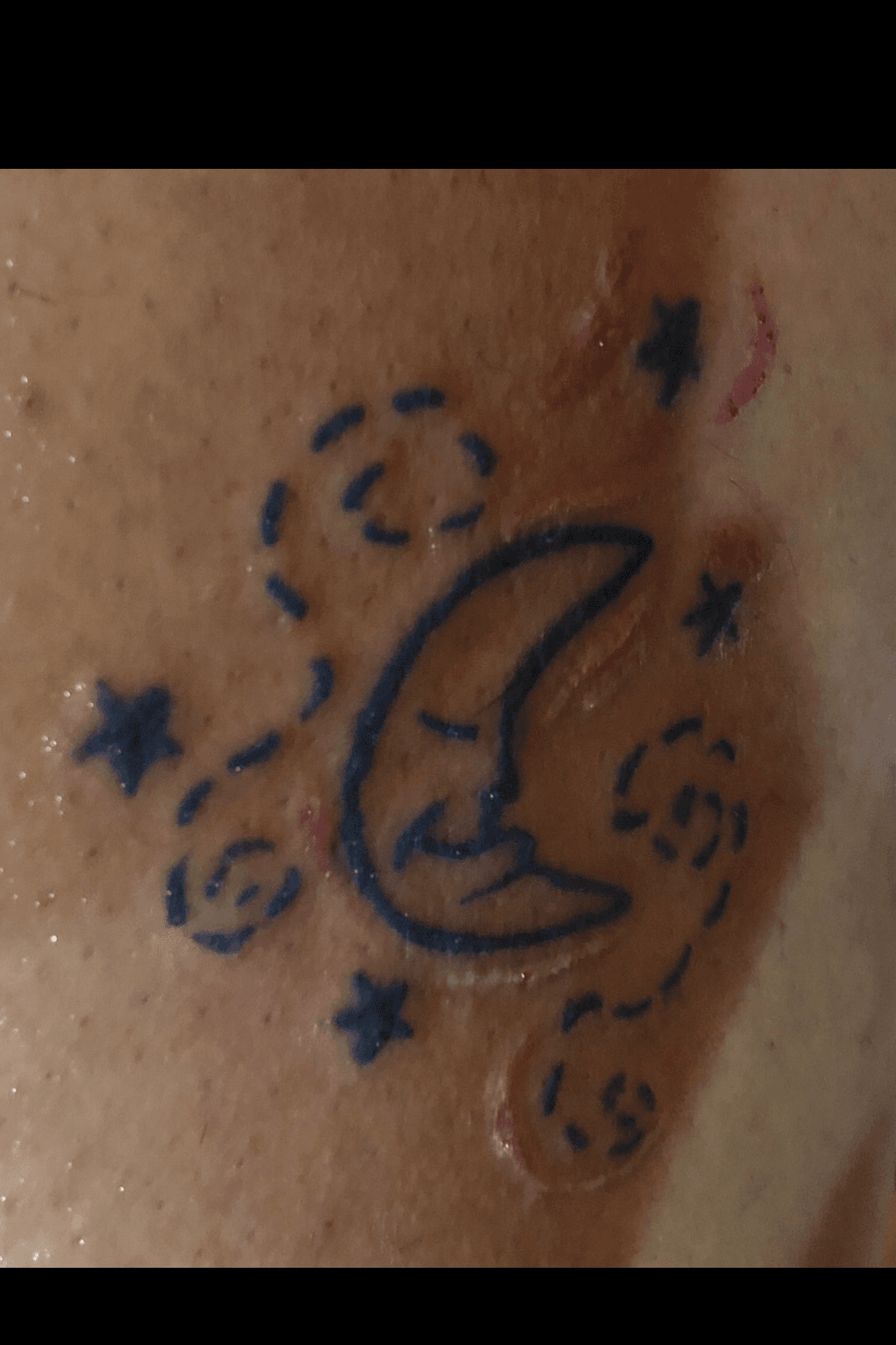 Tattoo uploaded by Katrine Hast  Lotus mandala  khast khasttattoo  design linework  Tattoodo
