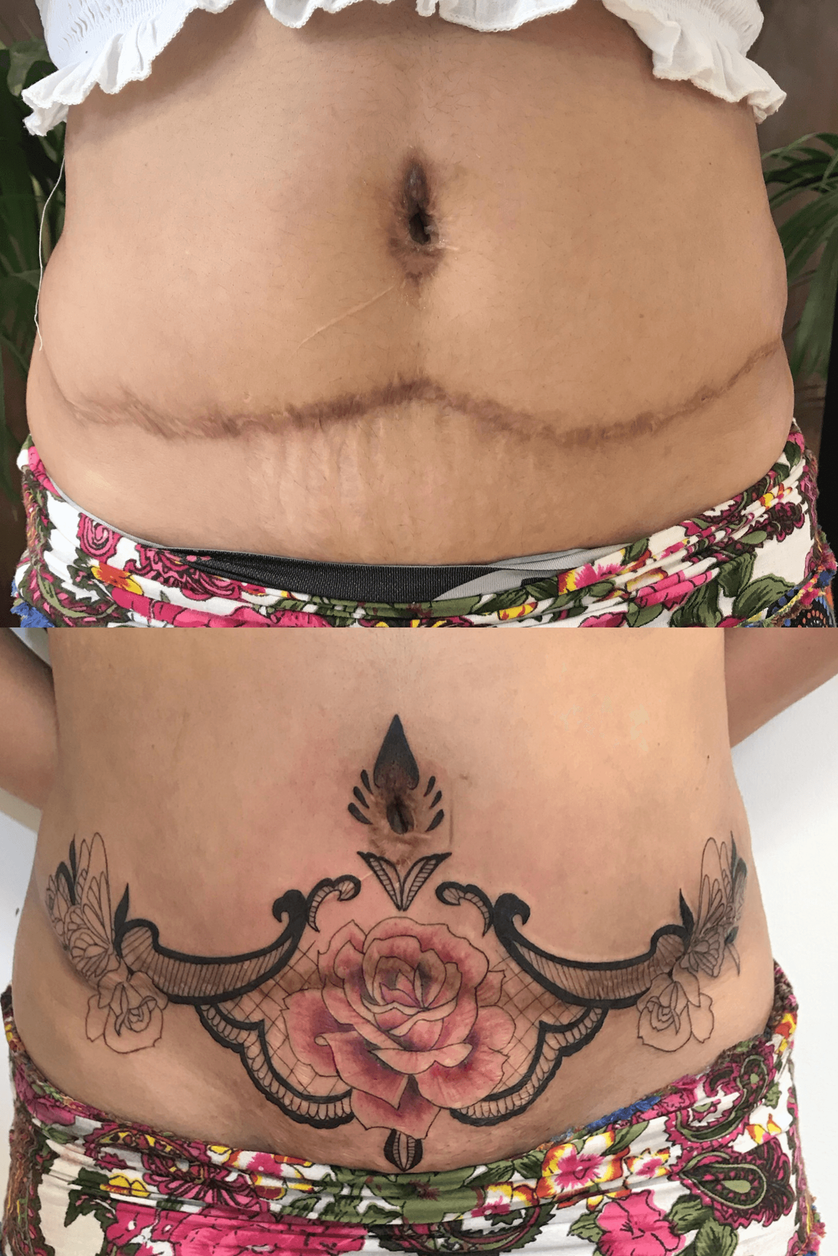 Planning on getting a stomach tattoo mainly to cover a tummy tuck  I know  many tattoos and its placement are more accepted than others  Whats your  thoughts on them trashy 