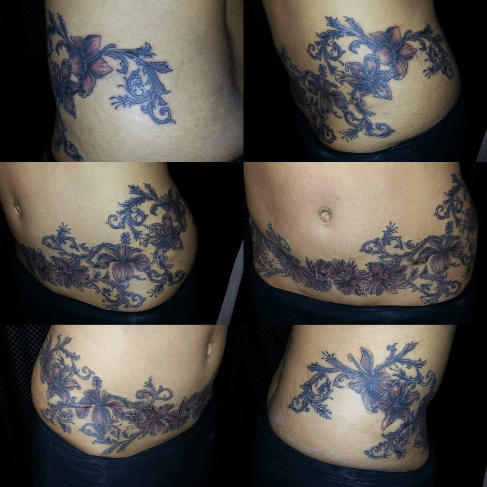 Can You Tattoo Over Stretch Marks  TattooProfy
