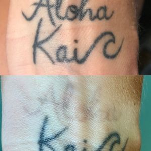 @1pointtattooremoval 1 Point Tattoo Kailua Location 