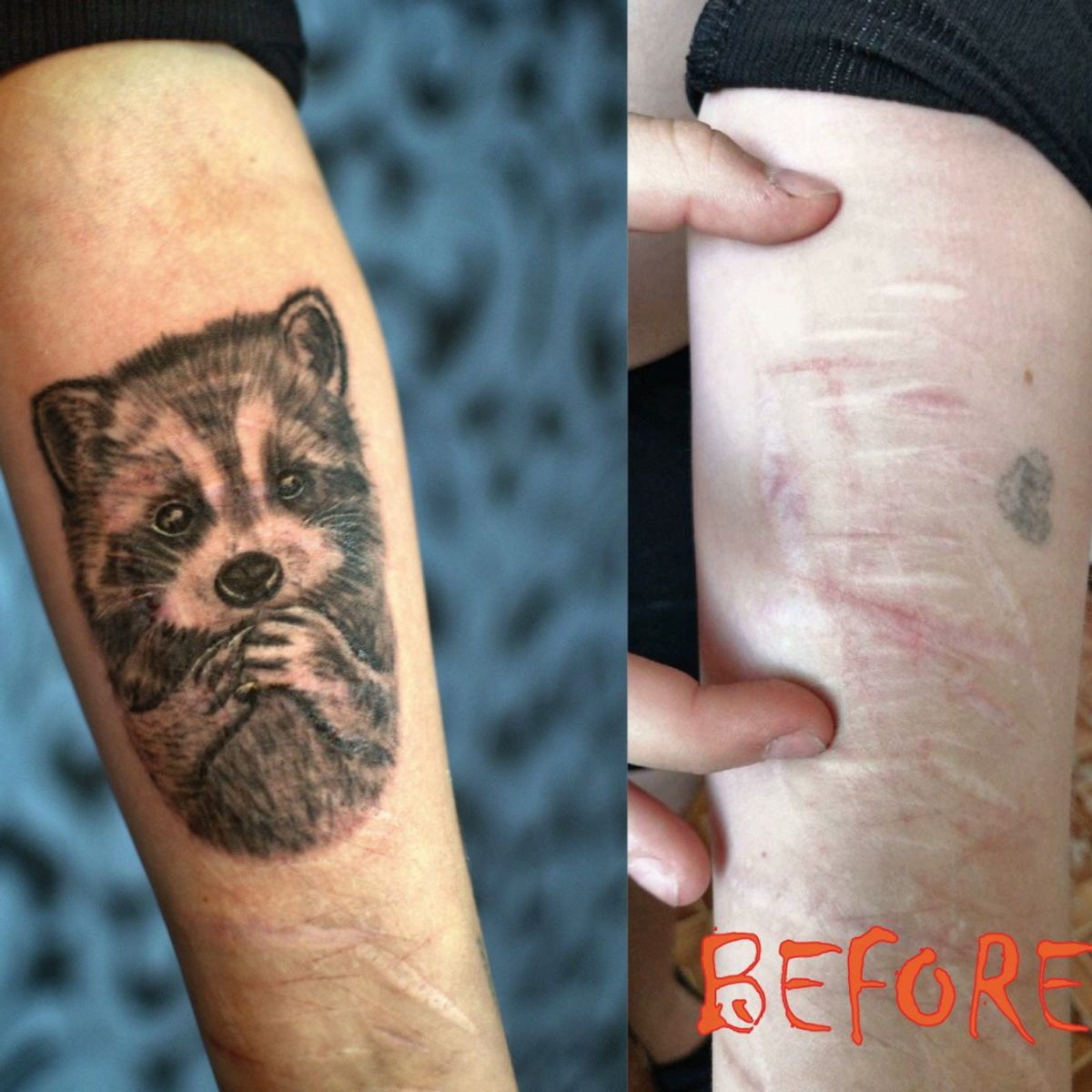 Перекрыть шрам татуировкой на руке