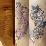 Cobertura de cicatriz com Tatuagem 