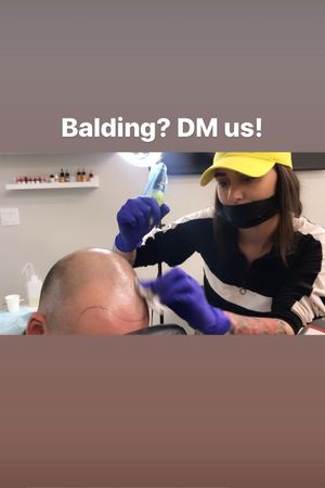 Balding? message me!! 