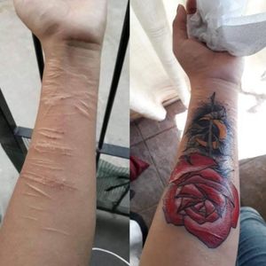 Cover tattooCicatrices cubiertas con tatuaje de rosa
