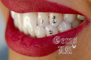 Tooth bling by Gems LA #GemsLA
