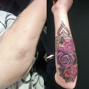 Prekrivanje oziljaka. Tattoo u boji,ruze i mandale.Radjeno na podlaktici.Zakazivanje Viber 0612828677 ili Instagram @ink_ra_tattoo#rosetattoo #roses #mandalatattoo  #mandala #colortattoo 