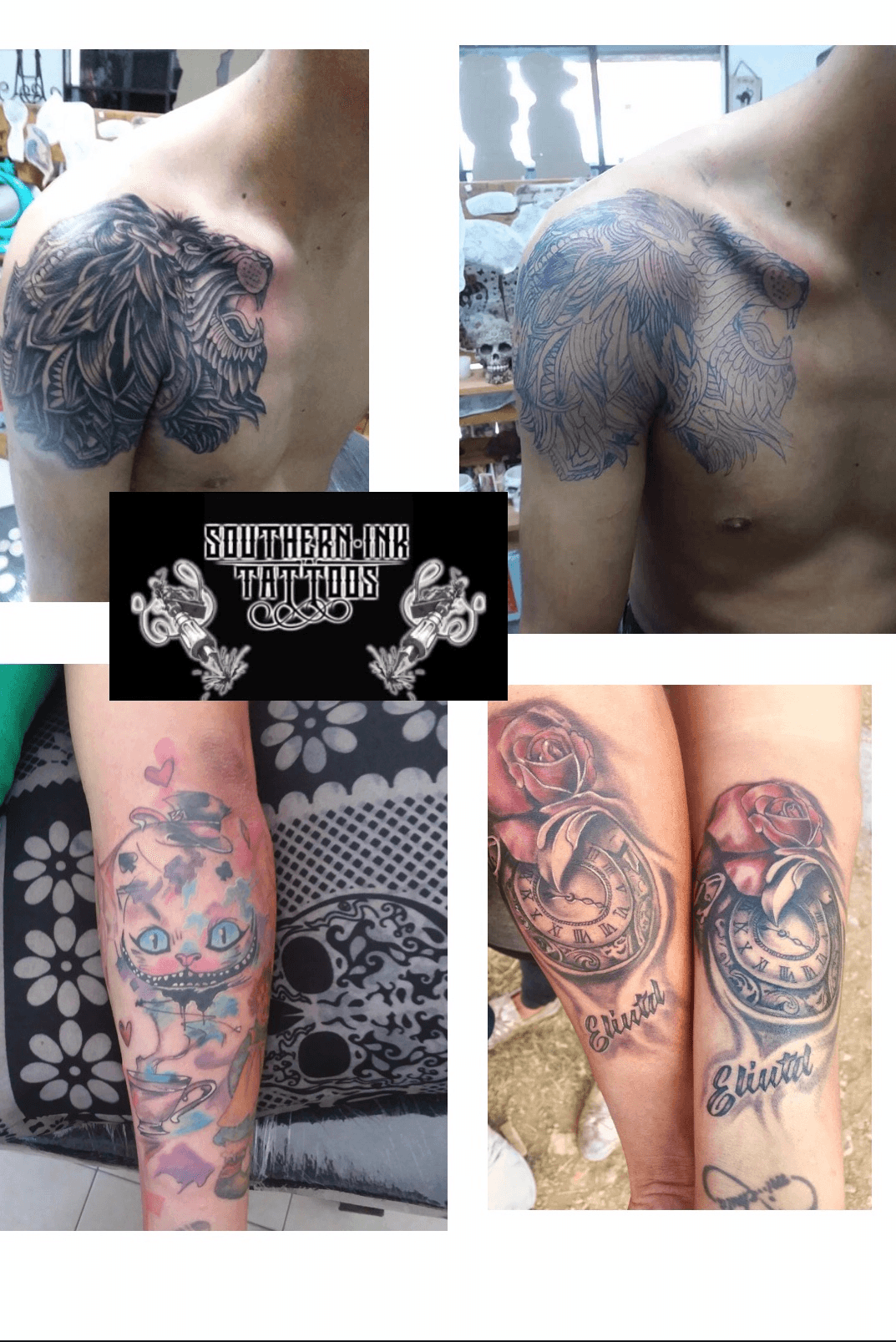 Details more than 63 tattoo removal utah  thtantai2