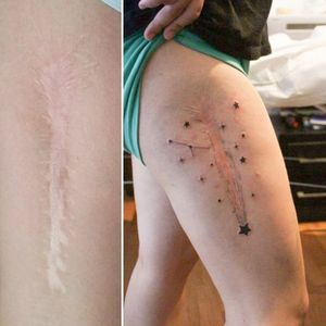 From a scar, to a falling star. Custom tattoo#scar #coverup #fallingstar #stars 