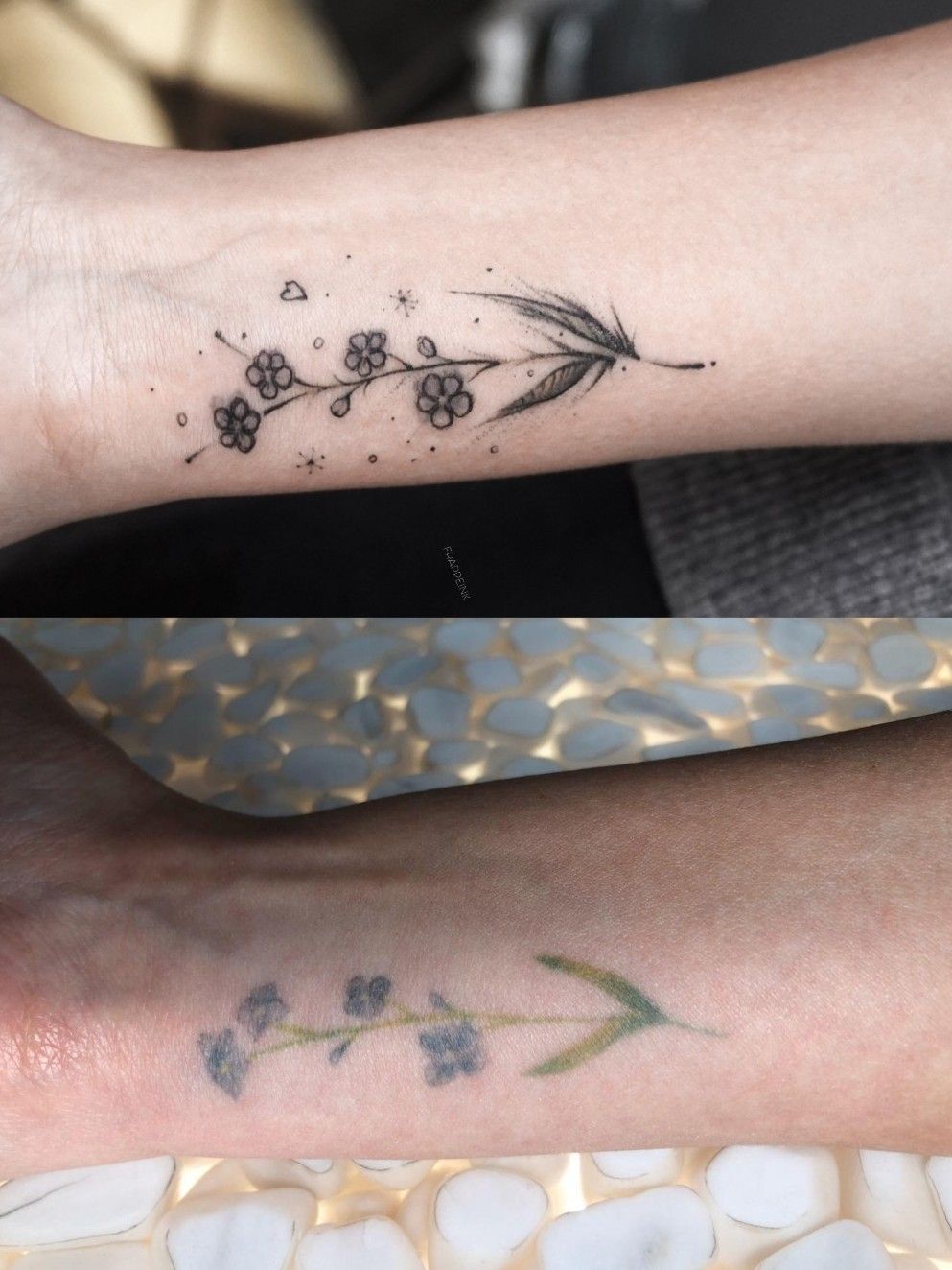 When Can You Tattoo Over Laser Tattoo Removal  Removery