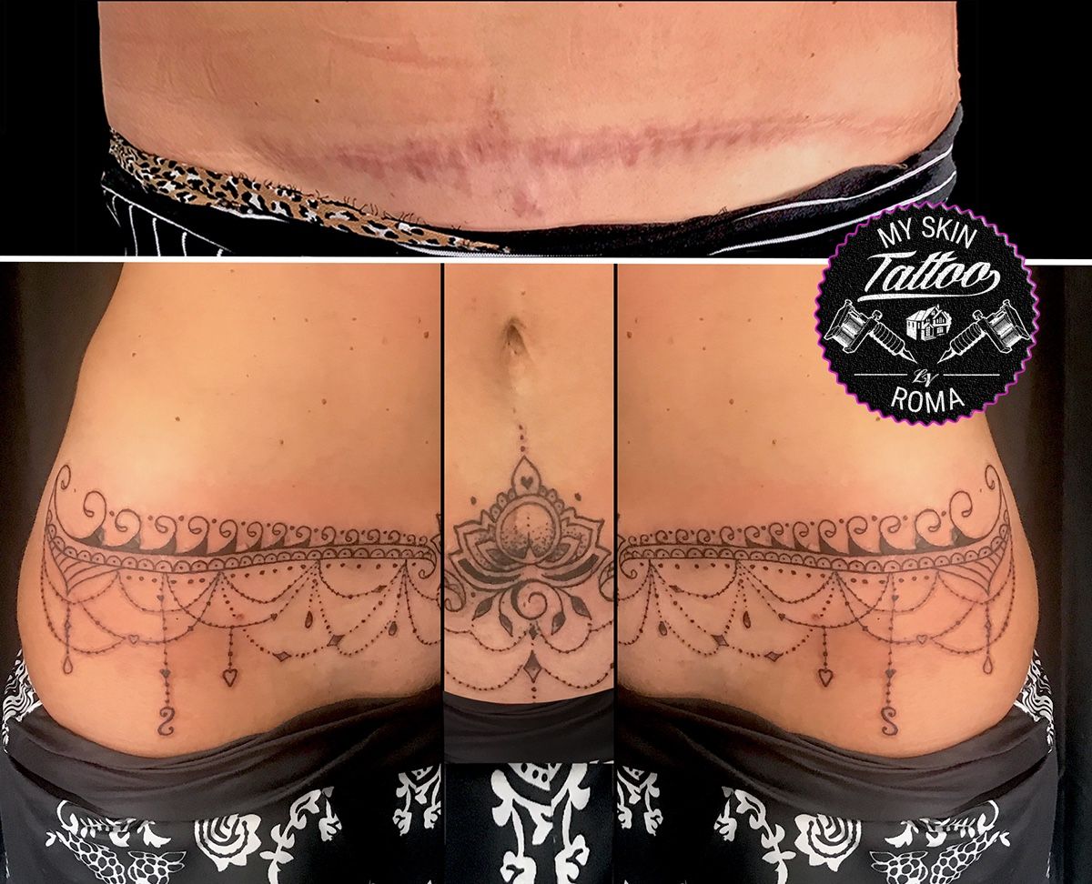 Top More Than 51 Tummy Tuck Cover Up Tattoo Incdgdbentre