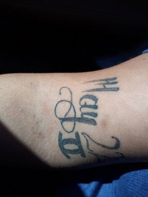 Part of my sons arm