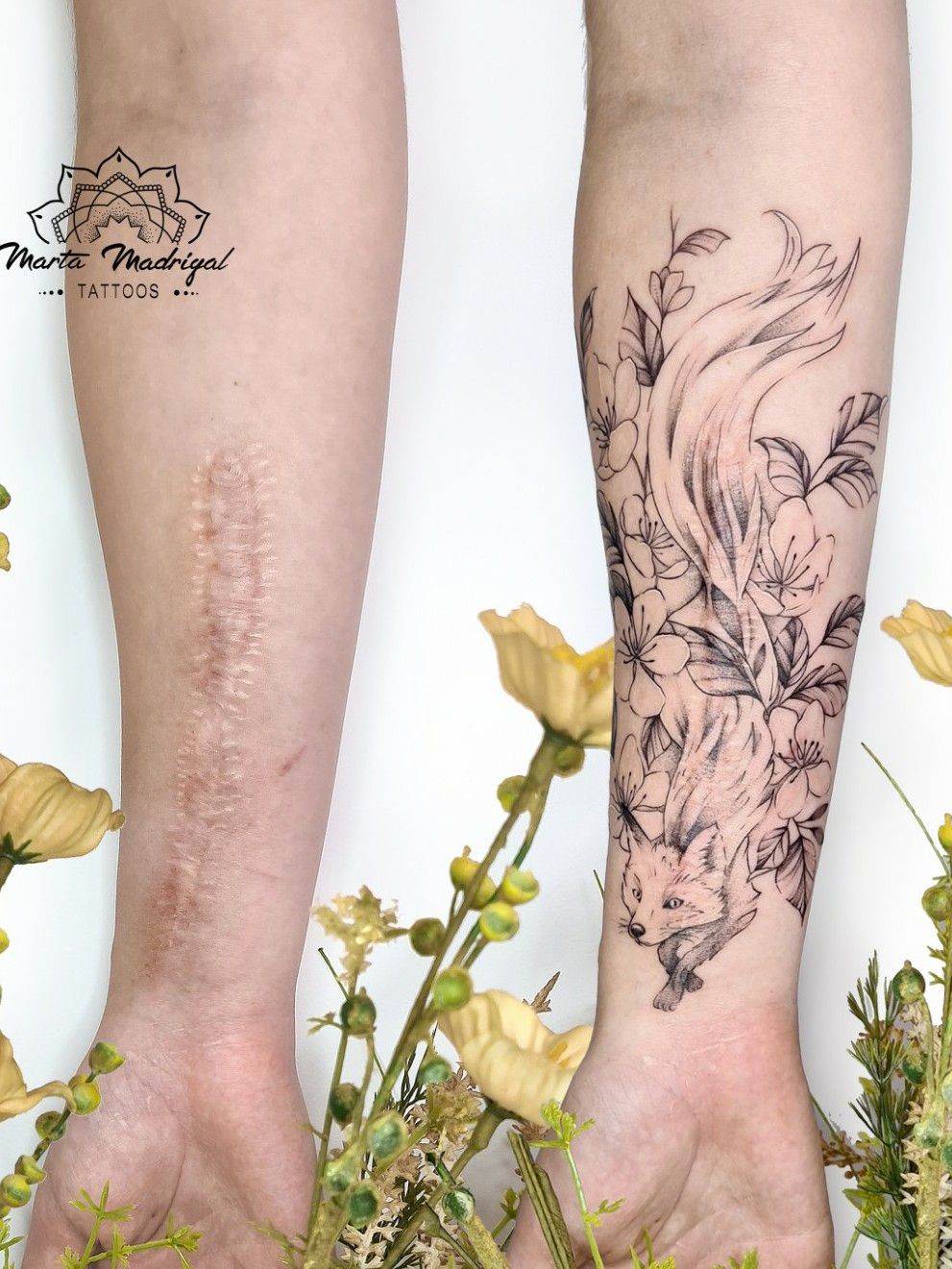Clever tattoo designs that turn scars into beautiful works of art