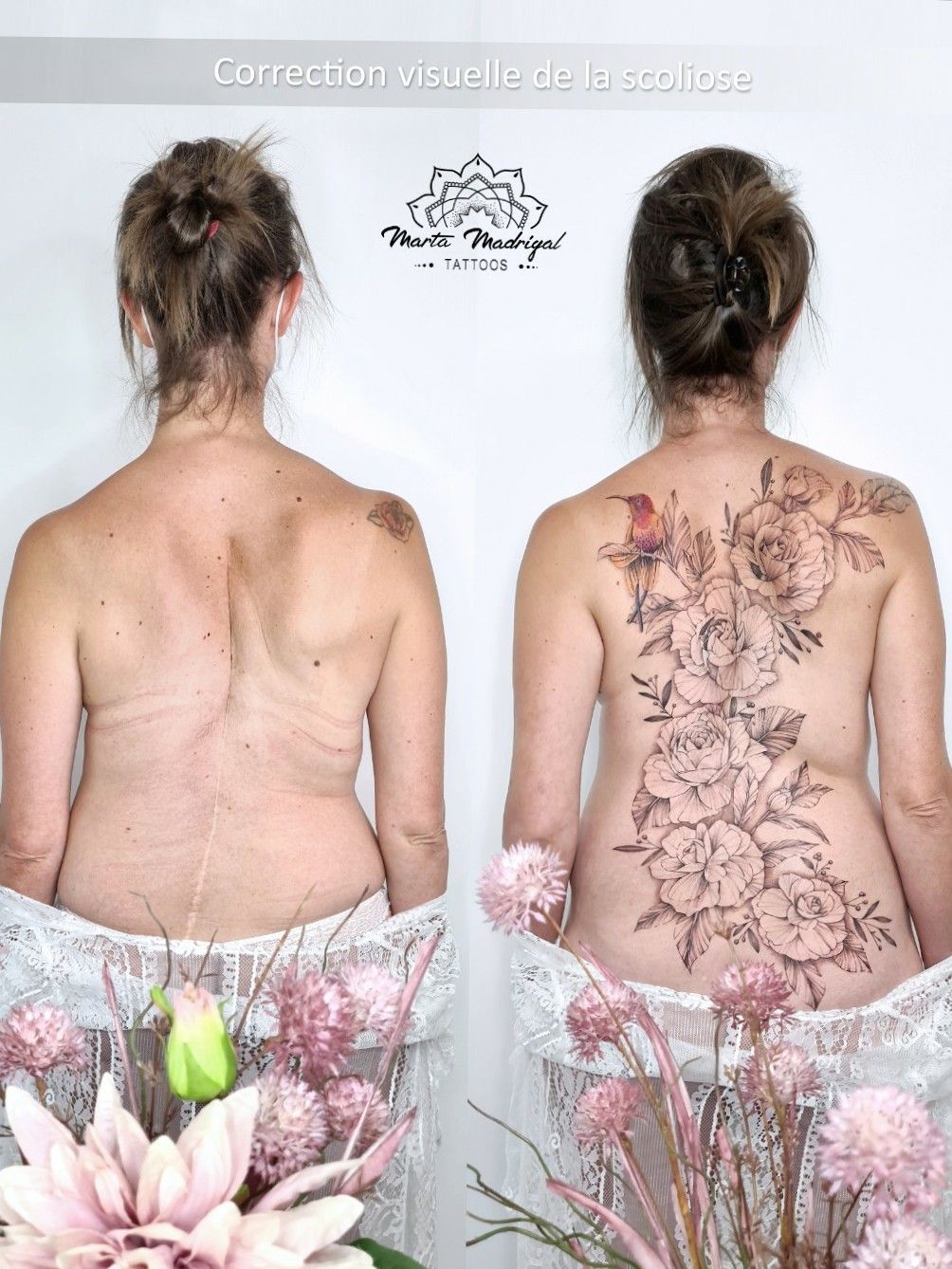 Scoliosis Health  Loving this 3D tattoo very unique I have never
