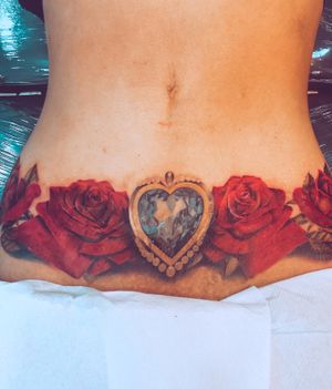 Cobertura de cicatriz. Rosas