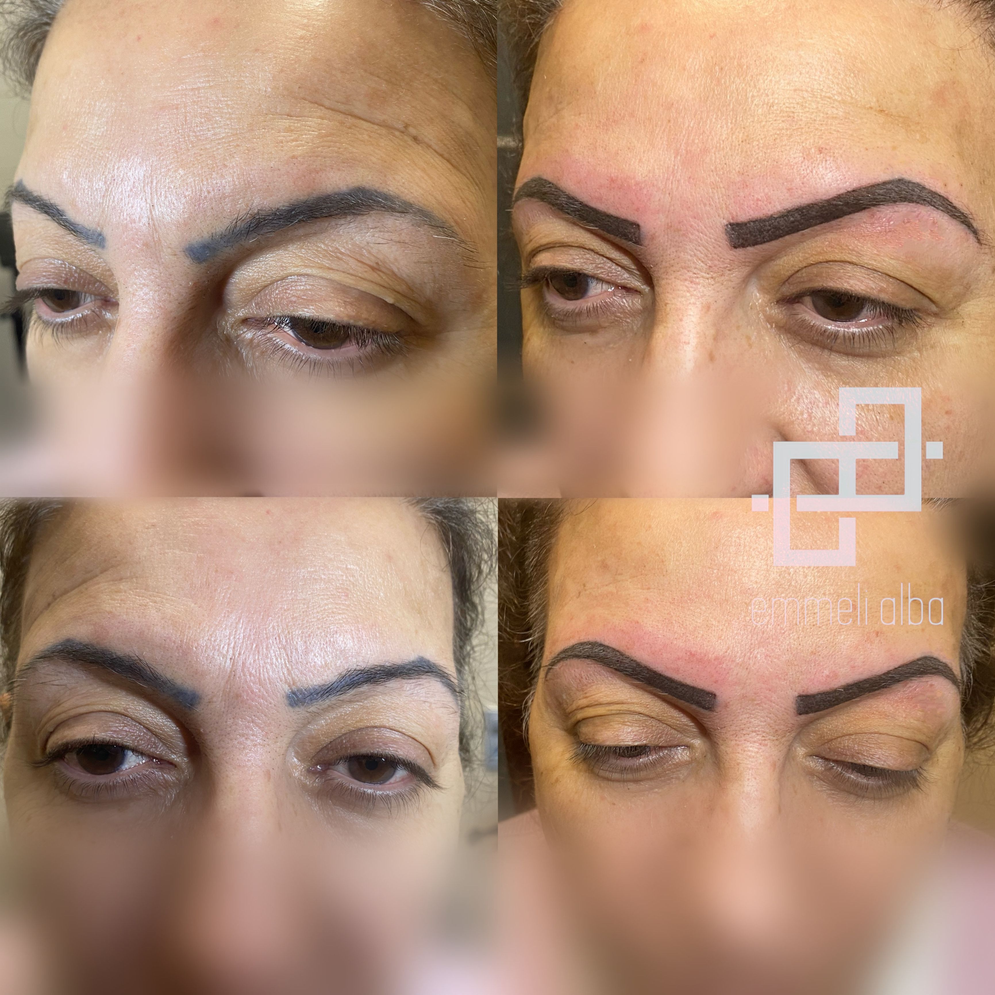 Permanent Eyebrows - The Dermatography Clinic