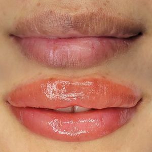 Dark lips neutralization. As of today it is a Top procedure in PMU world 