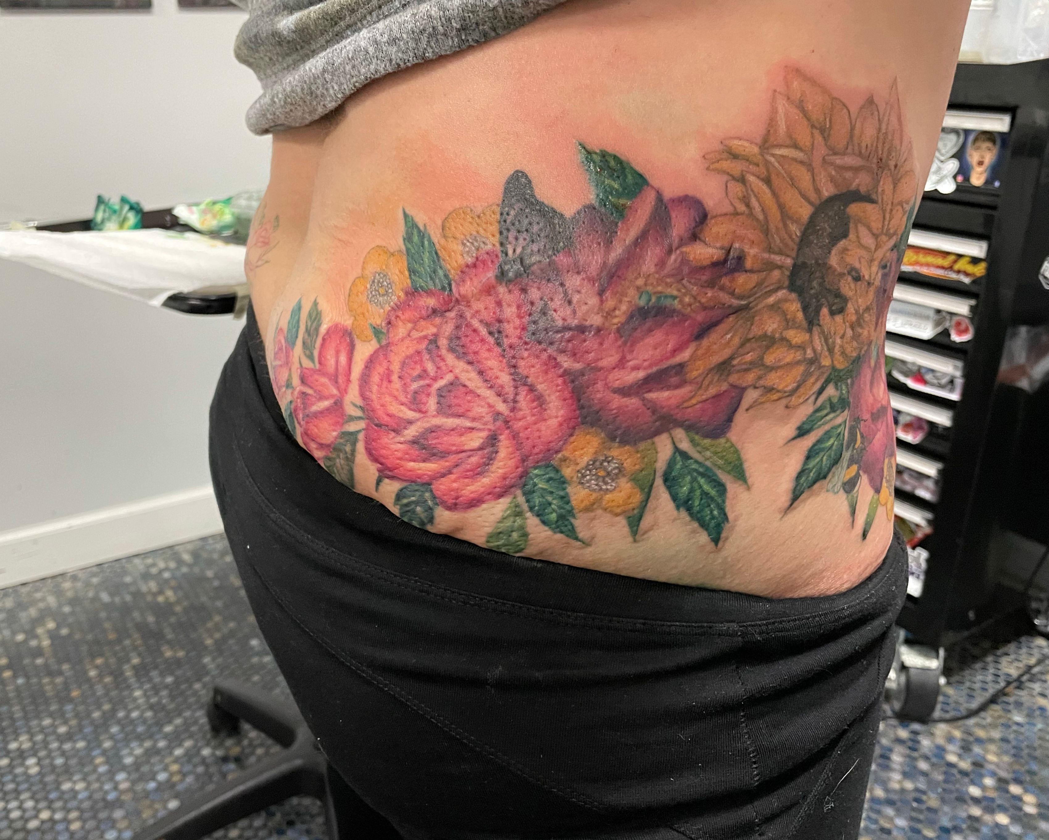 Keloid Scar Tranformation  My client has been wanting to remove her scars  ever since her hip surgery that happened when she was a little  Instagram