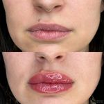 Soft and natural lip blush tattoo. Lip Blush adds a subtle pop of color to your lips. Color softens 40%-60% when healed, swelling lasts 24-48 hours. 