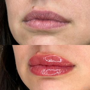 Soft and natural lip blush tattoo. Lip Blush adds a subtle pop of color to your lips. Color softens 40%-60% when healed, swelling lasts 24-48 hours.