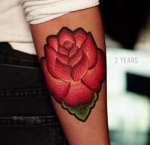 healed 2 years 