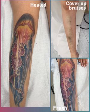 The jellyfish cover up