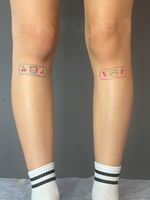Cute bandaids (kids drawing style) under knees