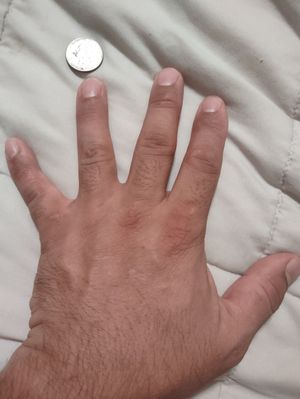 Ring Finger, left hand