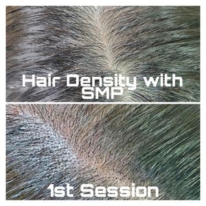 Hair Density Treatment This was done with scalp micropigmentation (SMP)This process takes 3-5 sessions, results and need will be on each individual.   SMP is a perfect nonsurgical solution for hairloss on women, men and all ages. #scalpmicropigmentation #smp #Sacramento #sanfrancisco 