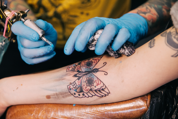 Have questions about tattoo removal services in San Antonio TX  EOS Tattoo  Removal