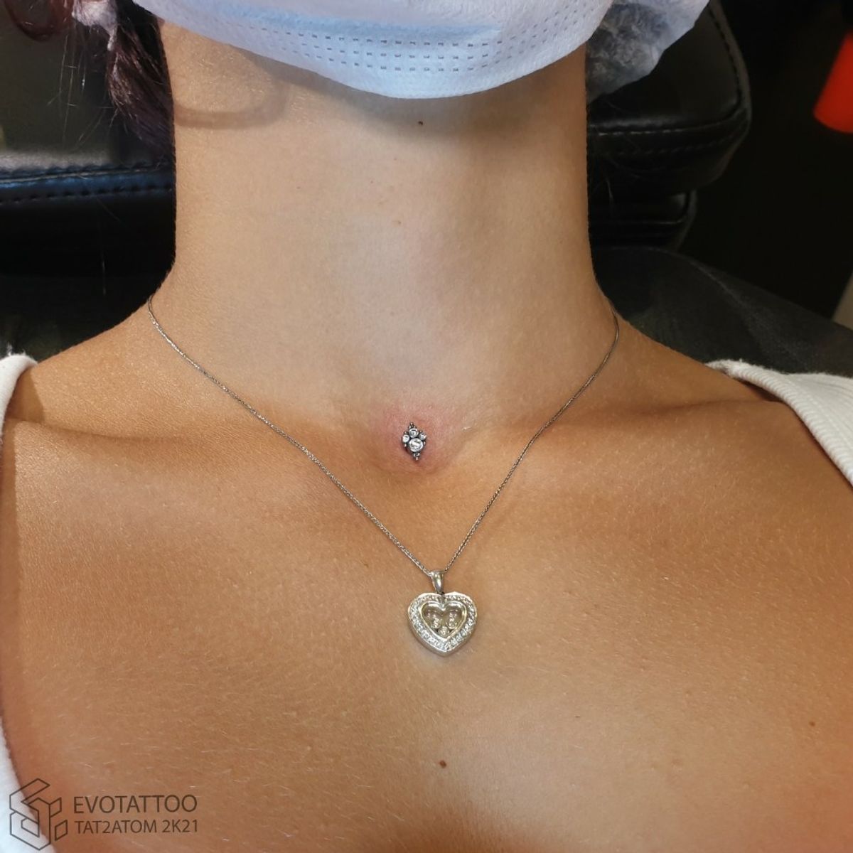 Tattoo uploaded by Вадим • Почистили микродермал от скопившихся сухих ...