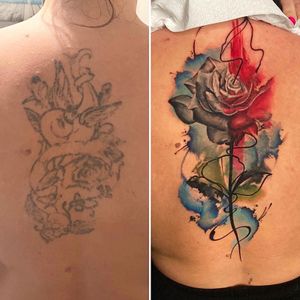 Cover up after 2 laser treatment