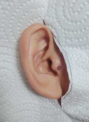 Ear Piercing (Tragus)