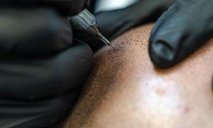 To some, the SMP tattooing process is painless! 