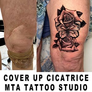 copertura cicatrice con tatuaggio - covering scar with tattoo
#mtatattoo #butterfly #rose #scar  