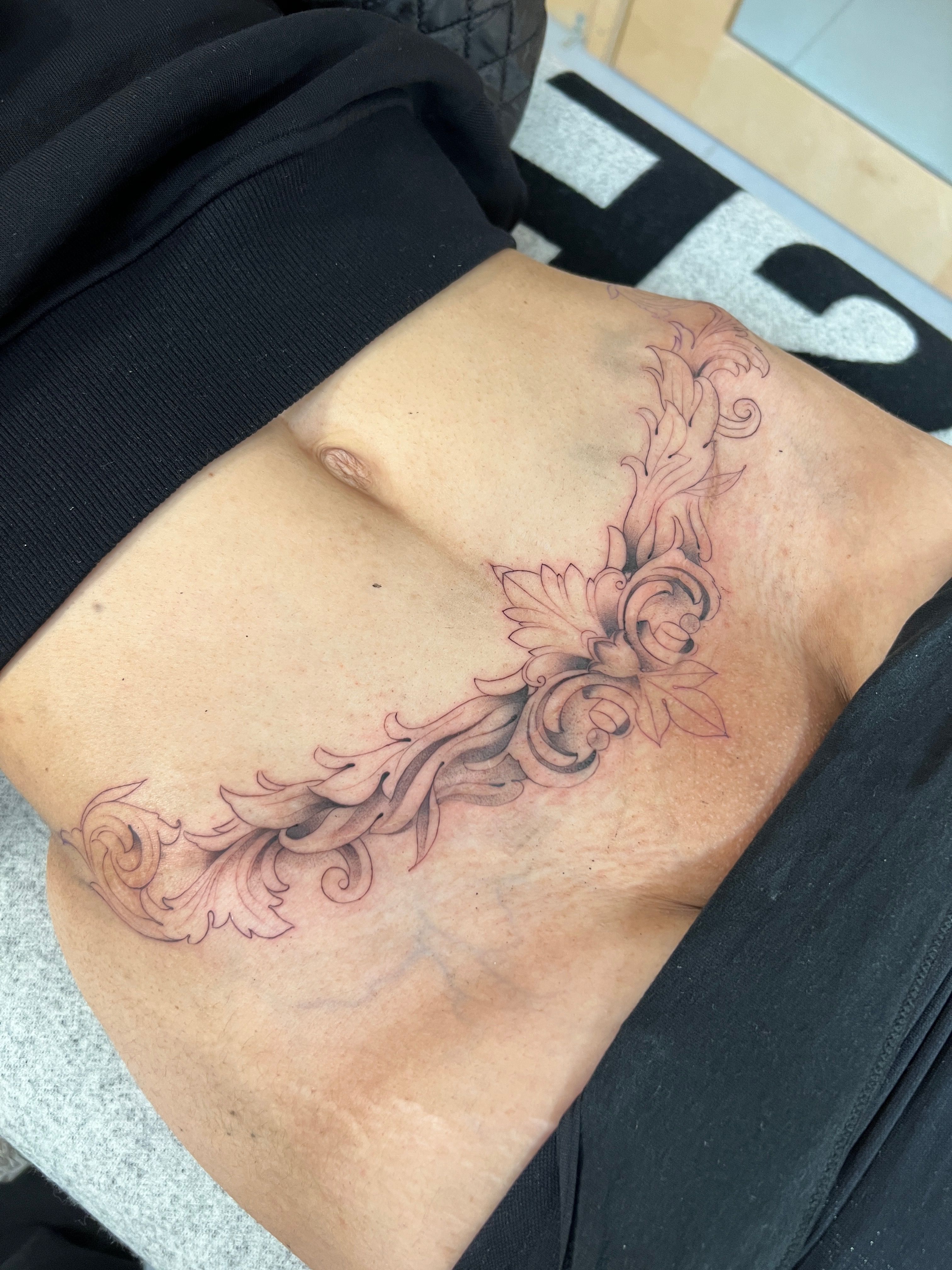 These Women Are Taking Ownership of Their Scars With Beautiful Tattoos