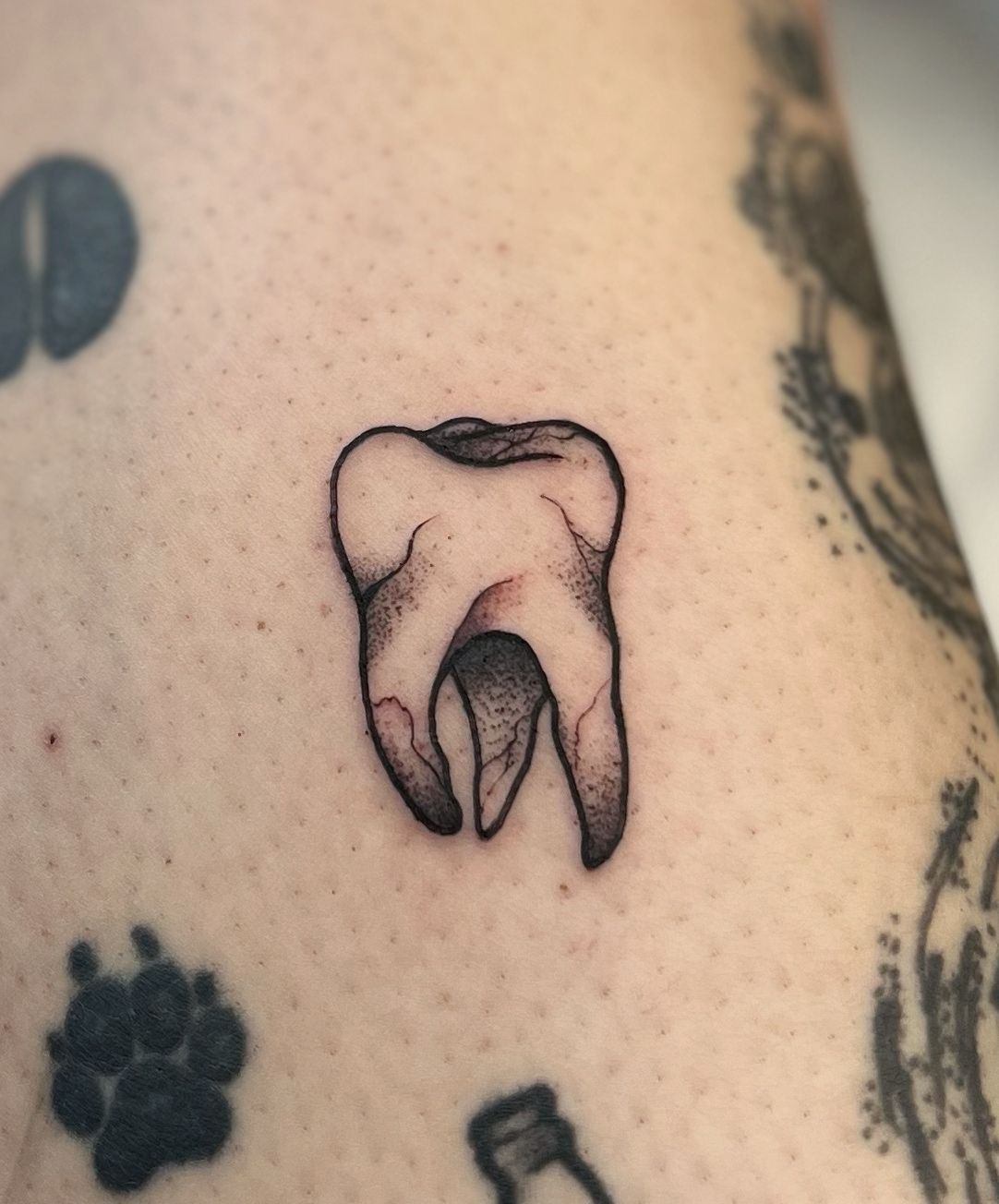 Micro-realistic tooth tattoo on the inner arm