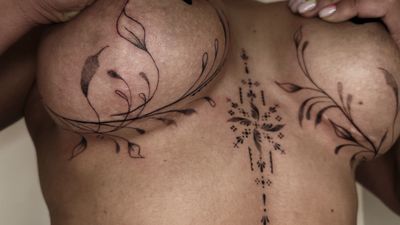 Surgery scar cover up, fineline ornamental and botanical shapes. By Tahsena Alam.