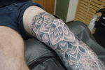 Geometric Knee Cap