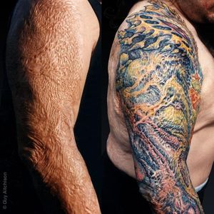 #burn #scars #sleeve #creativetattoos #tattooplacement