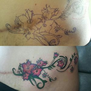 Tatuaje en cicatriz primera sesión!!!