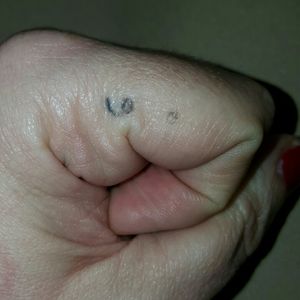 I knew I was taking a risk getting a tattoo on this part of my finger. And it has faded. But the semicolon speaks to my mental health recovery. And the process of recovery is often worn and distressed, just like the tattoo.
