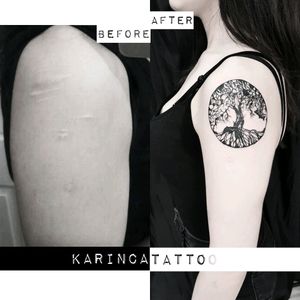 Cover up a scarInstagram: @karincatattoo#treeoflife #tattoo #scartattoo #coveruptattoo #covertattoo #shouldertattoo #istanbul