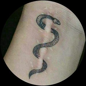 Super gemacht #scare #narben #tattoo #tattoos #tattooedwoman #eskulap