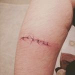 Some stitches cuz i fucked up :D #stitches