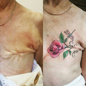 This lady is 80yrs old and got her first tattoo! #breastcancersurvivor #breastcancerawareness #mastectomytattoo #rose #dragonfly #chesttatttoo #inspirational #brave #strength #beautifultattoo #itsnevertoolate